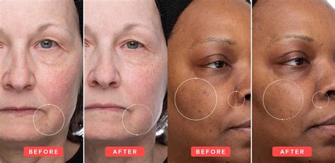 how long to see results from retinol|Retinol: Cream, Serum, What It Is, Benefits, How To Use.